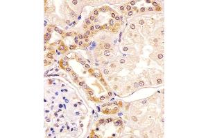 Antibody staining PKC beta1/2 in human kidney tissue sections by Immunohistochemistry (IHC-P - paraformaldehyde-fixed, paraffin-embedded sections). (PKC beta1/2 (AA 303-334) 抗体)