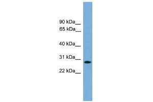 WB Suggested Anti-APOLD1 Antibody Titration:  0. (APOLD1 抗体  (Middle Region))