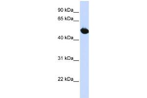 WB Suggested Anti-SLC2A9 Antibody Titration:  0. (SLC2A9 抗体  (Middle Region))