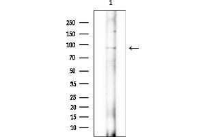 Western blot analysis of lysates from EC304 cells(heat-shock treatment), using RHG6 Antibody at 1/1000 dilution. (RHG6 (Internal Region) 抗体)