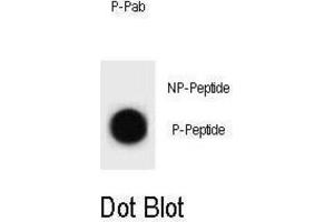 Dot Blot (DB) image for anti-Cyclin B2 (CCNB2) (pThr359) antibody (ABIN3002075) (Cyclin B2 抗体  (pThr359))