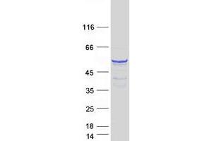 Western Blotting (WB) image for Cytoplasmic Polyadenylation Element Binding Protein 1 (CPEB1) (Transcript Variant 4) protein (Myc-DYKDDDDK Tag) (ABIN2712530)