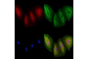 ABIN6260397 and ABIN6278429 staining  cells by IF/ICC.