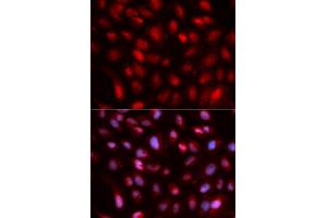 Immunofluorescence analysis of U2OS cells using SUMO2 antibody. (SUMO2 抗体)