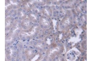 Detection of ADD1 in Mouse Kidney Tissue using Polyclonal Antibody to Alpha Adducin (ADD1) (alpha Adducin 抗体  (AA 388-560))