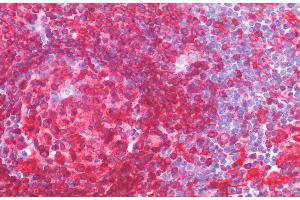 ABIN2613404 (5 μg/mL) staining of paraffin embedded Human Spleen. (CD74 抗体  (AA 159-171))