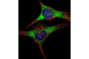 Immunofluorescent analysis of 4 % paraformaldehyde-fixed, 0. (GARS 抗体  (AA 15-305))