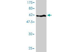 Western Blot detection against Immunogen (71. (SERPINH1 抗体  (AA 1-418))