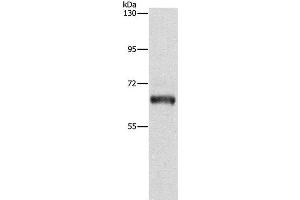 Western Blot analysis of Lovo cell using KLC1 Polyclonal Antibody at dilution of 1:500 (KLC1 抗体)