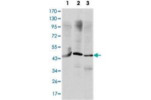 Western blot analysis using OTX2 monoclonal antobody, clone 1H12G8B2  against HepG2 (1), Jurkat (2), and NTERA-2 (3) cell lysate. (OTX2 抗体)