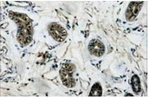 Immunohistochemistry of paraffin-embedded Human colon tissue using beta Tubulin Monoclonal Antibody at dilution of 1:200. (TUBB 抗体)