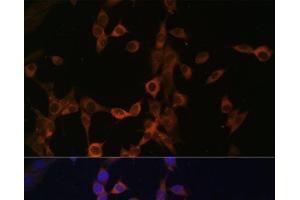 Immunofluorescence analysis of NIH/3T3 cells using PPP3R1 Polyclonal Antibody at dilution of 1:100. (PPP3R1 抗体)
