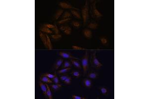 Immunofluorescence analysis of U-2 OS cells using TF antibody (ABIN7270888) at dilution of 1:100. (TFAP4 抗体)