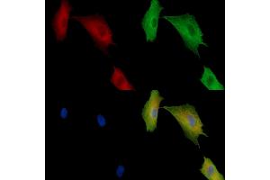 ABIN7096899 and ABIN7100965 staining  cells by IF/ICC.