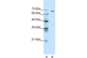 WB Suggested Anti-GABRQ Antibody Titration:  0. (GABRQ 抗体  (N-Term))