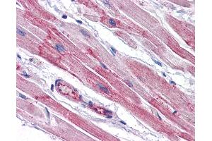 Anti-RWDD3 antibody IHC of human heart. (RWDD3 抗体  (N-Term))