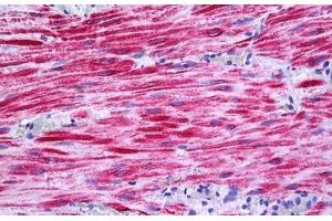 Human Intestine: Formalin-Fixed, Paraffin-Embedded (FFPE) (PKD2 抗体  (AA 829-878))