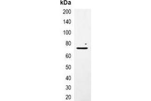Immunoprecipitation of mCherry-tagged protein from HEK293T cells transfected with vector overexpressing mCherry tag, using Anti-mCherry-tag Antibody. (mCherry 抗体)