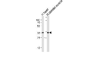 Western blot analysis of lysates from human heart and human skeletal muscle tissue lysate (from left to right), using DIO2 Antibody at 1:1000 at each lane. (DIO2 抗体  (AA 165-191))