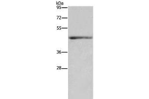 Western Blot analysis of Mouse heart tissue using IL5RA Polyclonal Antibody at dilution of 1:650 (IL5RA 抗体)