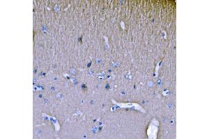 IHC analysis of SH3GL2 using anti-SH3GL2 antibody (ABIN7602229). (SH3G2 抗体  (AA 65-292))