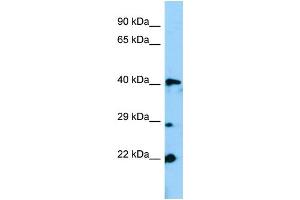WB Suggested Anti-Gm13152 Antibody Titration: 1. (Zfp982 抗体  (N-Term))