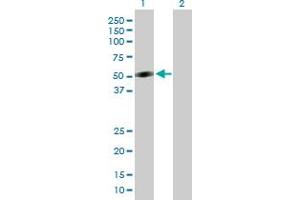 Western Blot analysis of CRLF1 expression in transfected 293T cell line by CRLF1 MaxPab polyclonal antibody. (CRLF1 抗体  (AA 1-422))