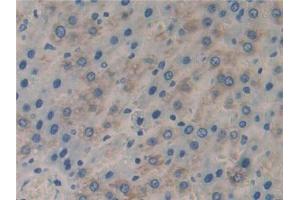 IHC-P analysis of Rat Liver Tissue, with DAB staining. (FLIP 抗体  (AA 43-281))