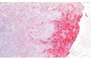Detection of DGKa in Human Tonsil Tissue using Polyclonal Antibody to Diacylglycerol Kinase Alpha (DGKa) (DGKA 抗体  (AA 305-531))