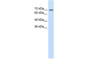 WB Suggested Anti-EPS8L1 Antibody Titration:  1. (EPS8-Like 1 抗体  (N-Term))