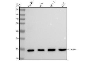 Western blot analysis of NDUFB4 using anti-NDUFB4 antibody (ABIN7605676).