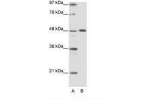 Image no. 1 for anti-Zinc Finger Protein 259 (znf259) (C-Term) antibody (ABIN6736147) (ZNF259 抗体  (C-Term))