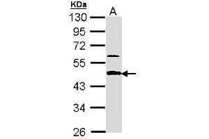 WB Image Sample (30 ug of whole cell lysate) A: A431 , 10% SDS PAGE antibody diluted at 1:1000 (APBB3 抗体  (Center))