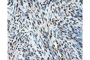 Immunohistochemical staining of paraffin-embedded endometrium tissue using anti-TIPRLmouse monoclonal antibody. (TIPRL 抗体)