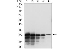 Western blot analysis using SARS-CoV-2-NP3 mAb against human SARS-CoV-2-N (AA: 240-419) recombinant protein. (SARS-CoV-2-NP3 (AA 240-419) 抗体)