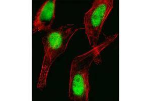 Fluorescent image of Hela cell stained with HOXC10 Antibody . (HOXC10 抗体  (C-Term))