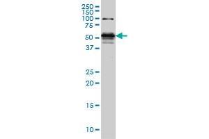 STK38 monoclonal antibody (M05), clone 6G11 Western Blot analysis of STK38 expression in Hela S3 NE . (STK38 抗体  (AA 365-465))