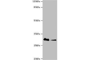Western blot All lanes: Carbonyl reductase [NADPH] 3 antibody at 10 μg/mL Lane 1: Hela whole cell lysate Lane 2: K562 whole cell lysate Secondary Goat polyclonal to rabbit IgG at 1/10000 dilution Predicted band size: 31 kDa Observed band size: 31 kDa (CBR3 抗体  (AA 118-277))