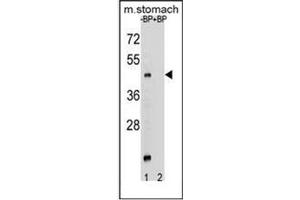 Western blot analysis of MBOAT4 Antibody (Center) Cat. (MBOAT4 抗体  (Middle Region))