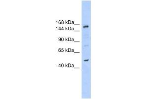 WB Suggested Anti-SHPRH Antibody Titration:  0. (SHPRH 抗体  (N-Term))