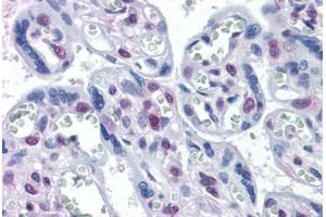 Human Placenta: Formalin-Fixed, Paraffin-Embedded (FFPE) (STK17A 抗体  (AA 301-414))