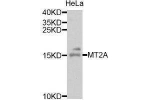 Western blot analysis of extracts of HeLa cells, using MT2A antibody.
