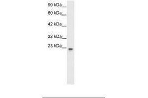 Image no. 2 for anti-General Transcription Factor IIF, Polypeptide 2, 30kDa (GTF2F2) (AA 132-181) antibody (ABIN6735771) (GTF2F2 抗体  (AA 132-181))