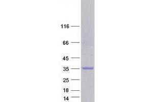 Western Blotting (WB) image for Muscleblind-Like Splicing Regulator 3 (MBNL3) (Transcript Variant 3) protein (Myc-DYKDDDDK Tag) (ABIN2725589)
