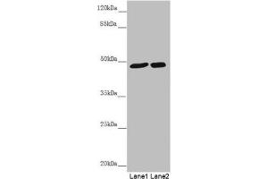 Western blot All lanes: PSTPIP1 antibody at 0. (PSTPIP1 抗体  (AA 157-416))