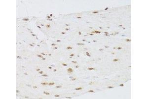 Immunohistochemistry of paraffin-embedded Human stomach using CSRP3 Polyclonal Antibody at dilution of 1:100 (40x lens). (CSRP3 抗体)