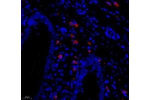 Immunofluorescence of paraffin embedded human appendix using MADCAM1 (ABIN7074695) at dilution of 1:1800 (400x lens) (MADCAM1 抗体)