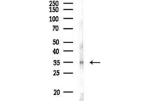 anti-Chemokine (C-C Motif) Receptor 10 (CCR10) (C-Term) antibody