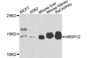 Western blot analysis of extracts of various cell lines, using HRSP12 antibody (ABIN5972464) at 1/1000 dilution. (HRSP12 抗体)