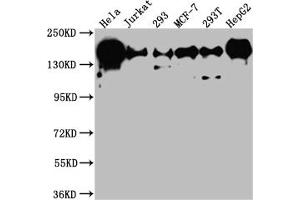 Western Blot Positive WB detected in: Hela whole cell lysate, Jurkat whole cell lysate, 293 whole cell lysate, MCF-7 whole cell lysate, 293T whole cell lysate, HepG2 whole cell lysate All lanes: PELP1 antibody at 1:1000 Secondary Goat polyclonal to rabbit IgG at 1/50000 dilution Predicted band size: 120 kDa Observed band size: 160 kDa (Recombinant PELP1 抗体)